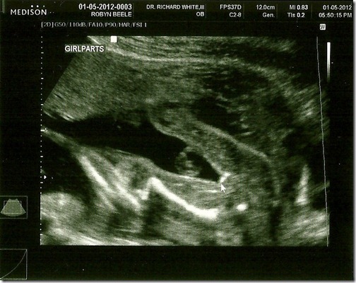 scan0003