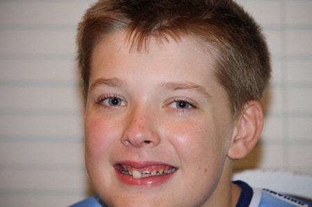 [Tiger%2520Shark%2520Tooth%2520Loss%2520Blog%255B3%255D.jpg]