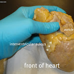 auricle_closer.jpg auricle_closer.jpg