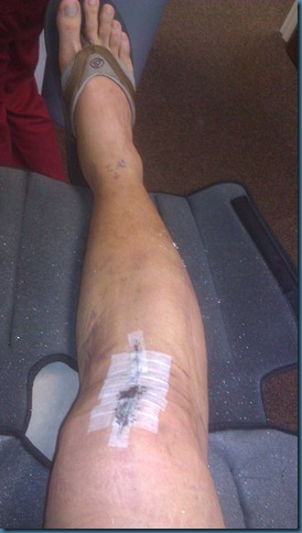 acl_post_op_tape