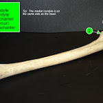 femur_labeled.jpg