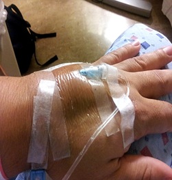 accidents du perfusion accidents du perfusion