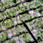 chloroplasts_hypertonic.jpg