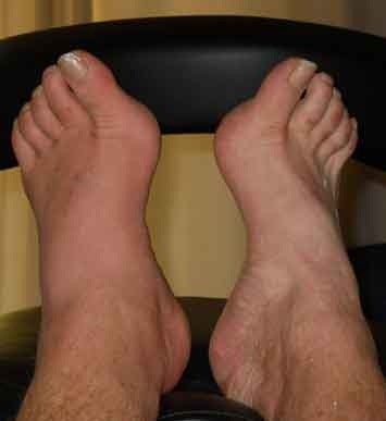 my-left-foot-1