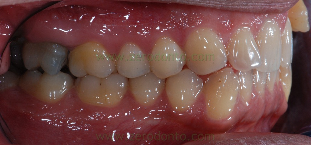 [3%255B1%255D.jpg]