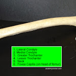 femur02_labeled.jpg