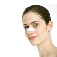 -rinoplastia- -rinoplastia-