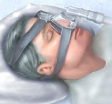 CPAP