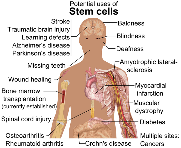 Stem_cell_treatments