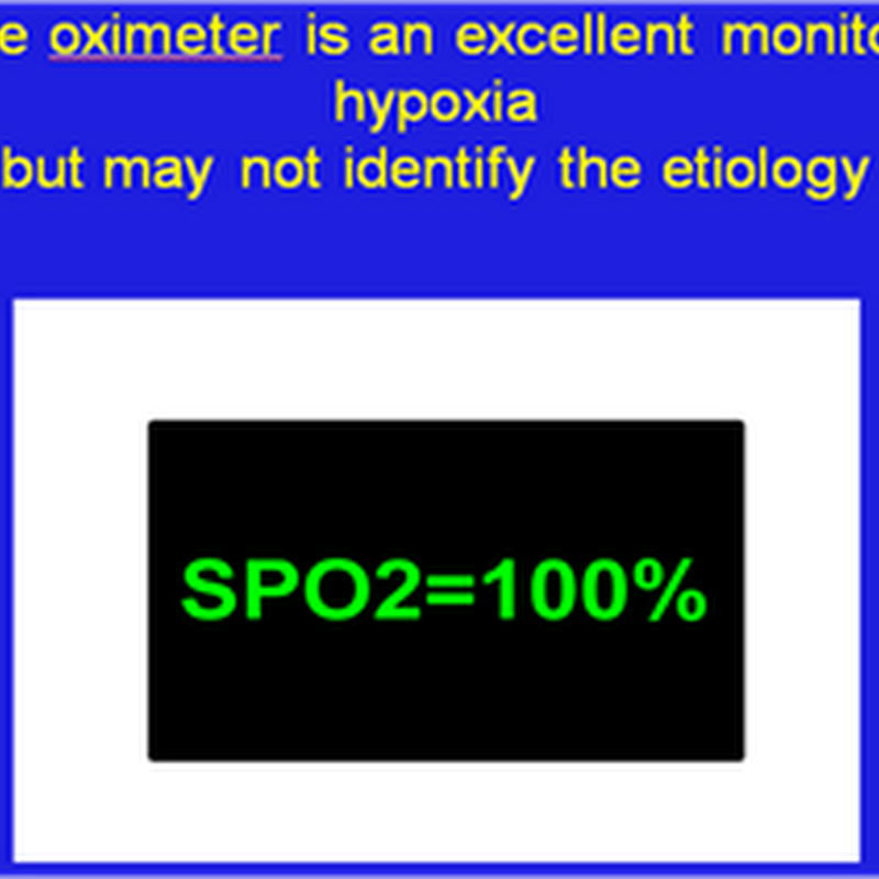 Capnography super simplified : The basics