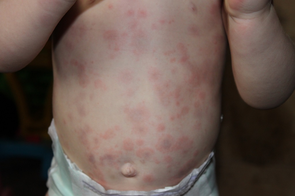 [2012-02-09%2520Hives%252C%2520Day%25203%2520-%25205%255B4%255D.jpg]