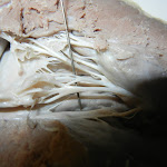 z_close_view_of_chordae_tendinae.JPG