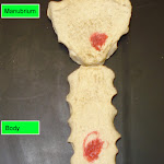 sternum_labeled.jpg