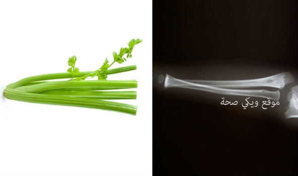 03-Celery-BoneFoods-That-Look-Like-Body-Parts-1 03-Celery-BoneFoods-That-Look-Like-Body-Parts-1
