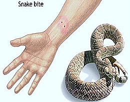 snake-bite