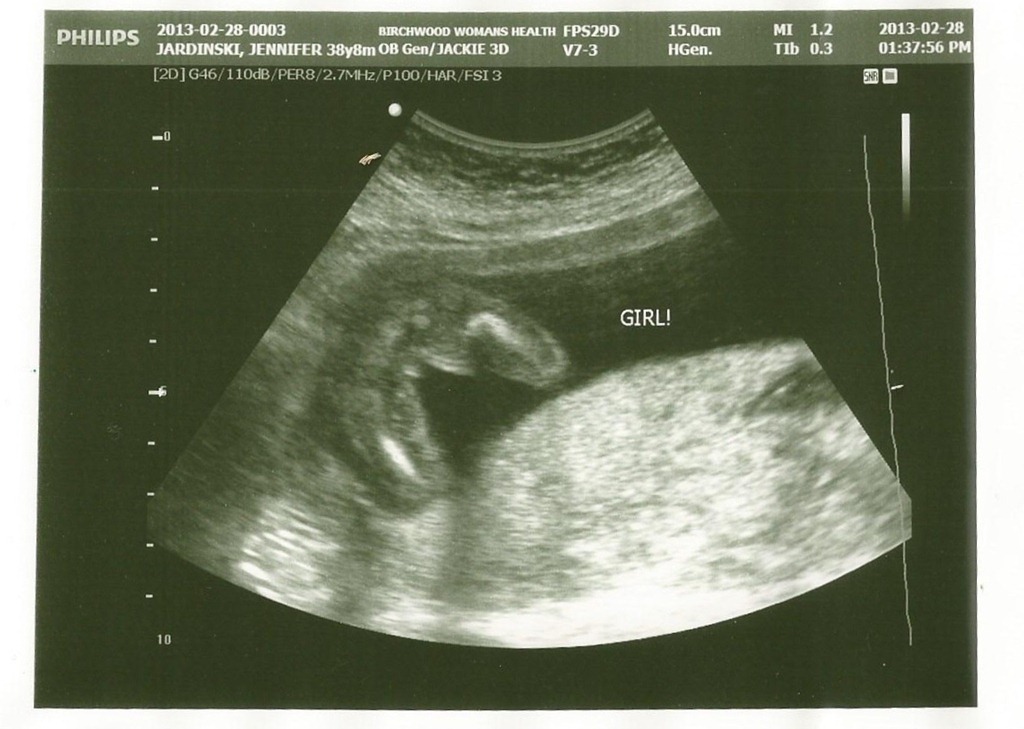 [babyaug2%255B4%255D.jpg]