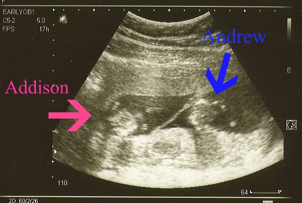 [scan0001-2%255B3%255D.jpg]
