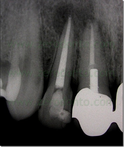 FIG N 5 