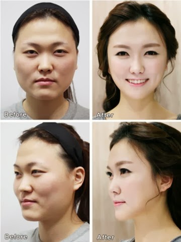 [korean-plastic-surgery-7%255B2%255D.jpg]