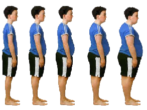 4737Obesity New 4737Obesity New