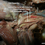 arch_of_aorta_L.JPG