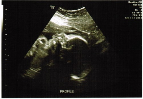 profile ultrasound 2