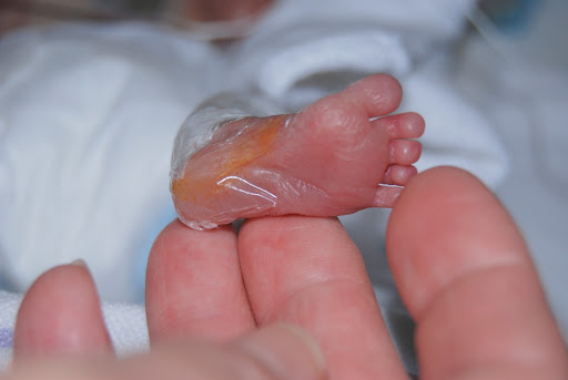 The tiny foot of Austin Brown, who was born approximately four months early and weighed 1 lb, 7 oz.  He lived for three days before developing a severe brain hemorrhage. He passed away in his parents' arms. (Photo used with permission from Tracey Brown)