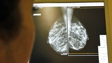 [mammogram3.jpg]