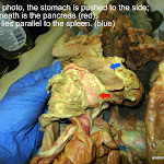 spleen_pancreas_L.JPG