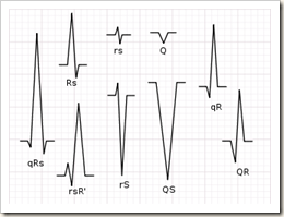 325px-QRS_nomenclature 325px-QRS_nomenclature