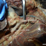 aorta_probe_L.JPG