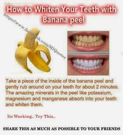 [BANANA3.jpg]