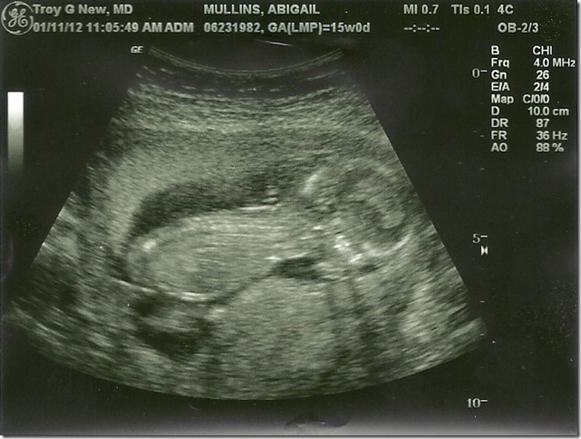 baby boy 10005