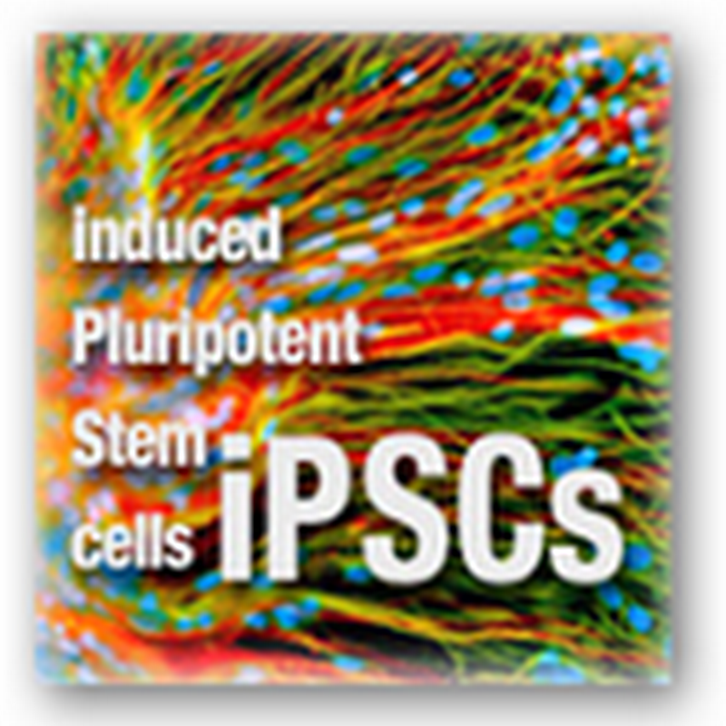Science Researchers Create Cells That Line Blood Vessels from iPSCs–May Lead to Patients Needing Less Blood Thinning Medications In the Future