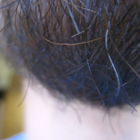 Gray chin hair