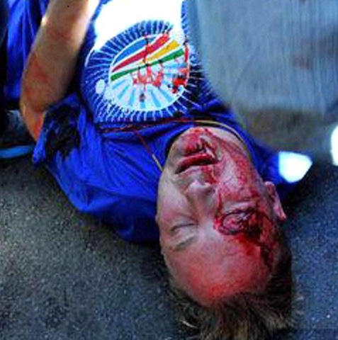 [DEMOCRATIC%2520ALLIANCE%2520MARCH%2520MAY%252015%25202012%2520MAN%2520INJURED%2520BY%2520BRICK%2520Johannesburg%255B5%255D.jpg]