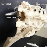 sacrum_labeled.JPG