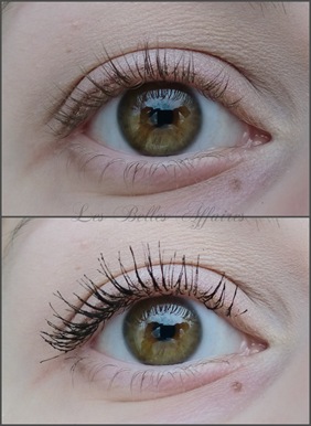 Auge