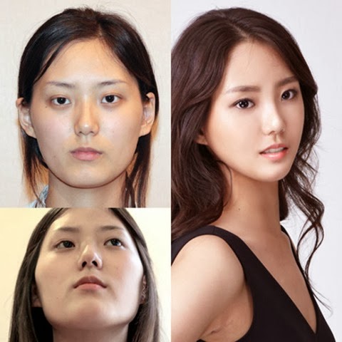 [korean-plastic-surgery-18%255B2%255D.jpg]