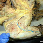 femoral_vein.JPG