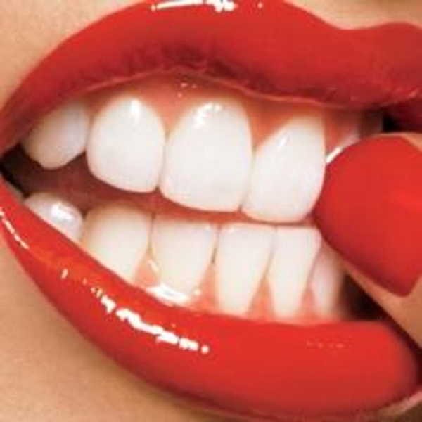 2- Dentes 2- Dentes