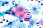 clamidia-microscopio.jpg
