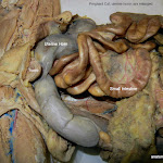 01_uterine_L.JPG