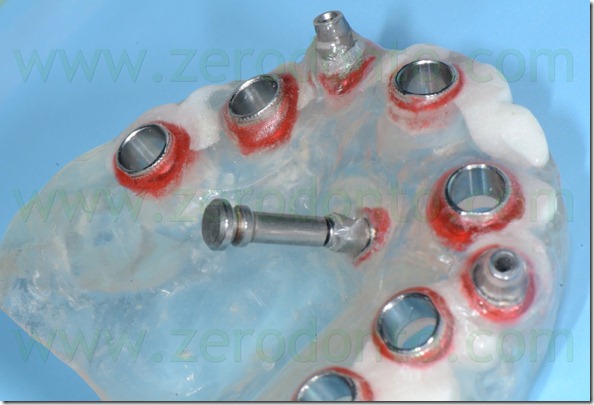 - (113) pin di stabilizzazione nobel - (113) pin di stabilizzazione nobel