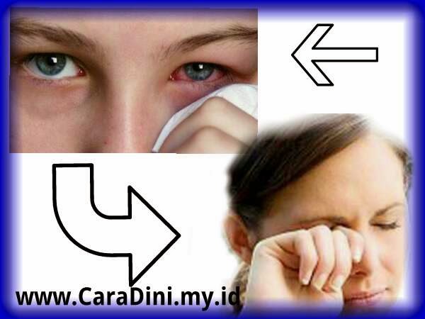 Sakit mata Sakit Mata