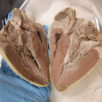 heart_hamburger_cut.JPG