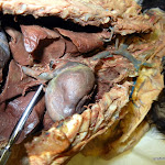inferior_vena_cava.JPG