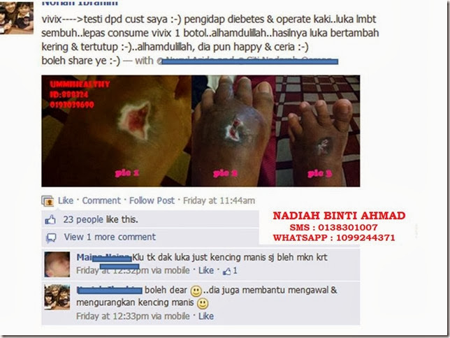 testi vivix testi vivix