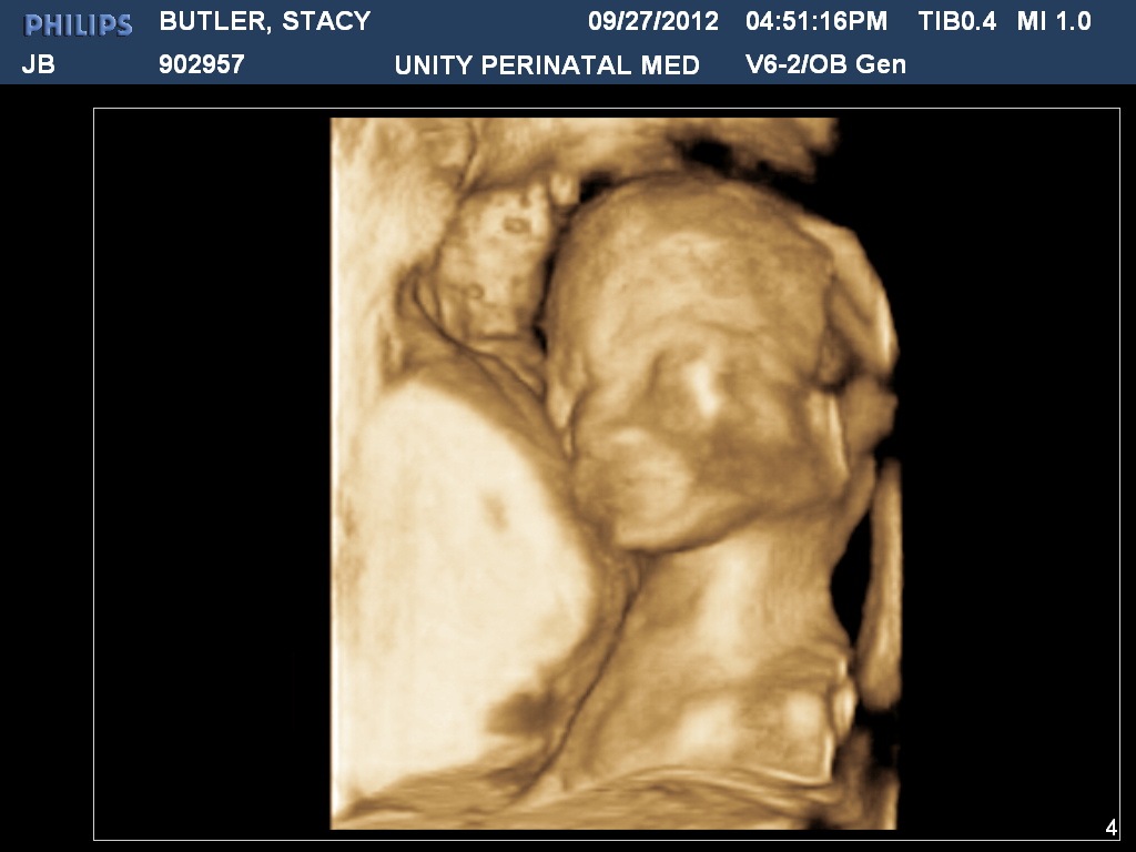 [BUTLERSTACY201209271651168252.jpg]