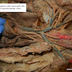 superior_vena_cava_L.JPG